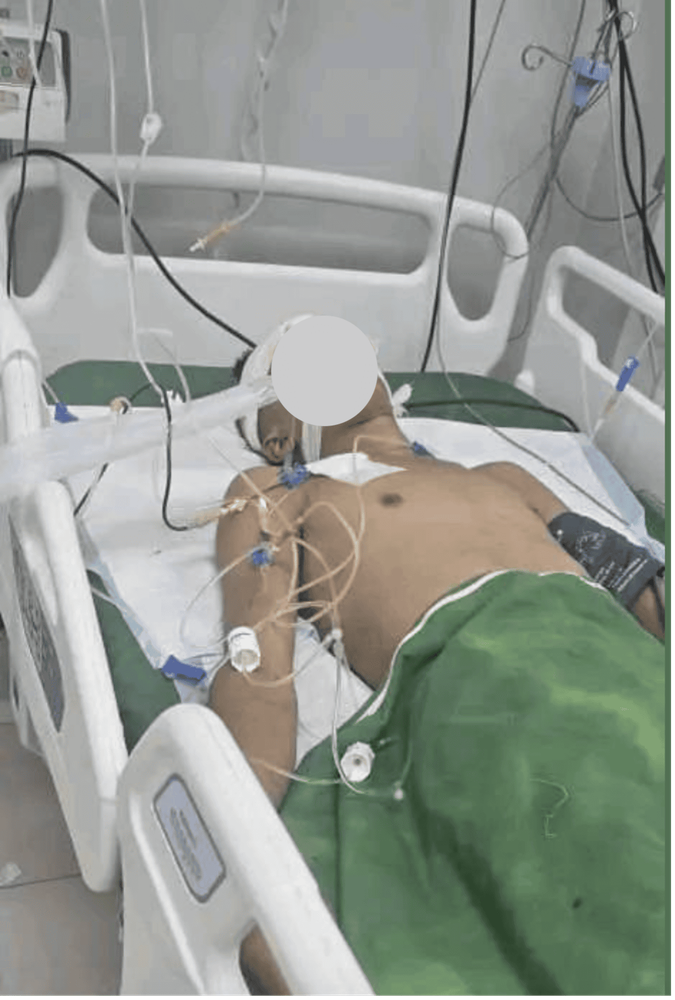 لقطة شاشة من منشور صدام القاهري على الفيسبوك، تظهر حسين عبدالرحمن الجبزي قبل وفاته وأثناء تواجده في المستشفى. تم التقاطها وتمويهها من قبل الأرشيف اليمني بتاريخ 22 كانون الأول/ديسمبر 2025.